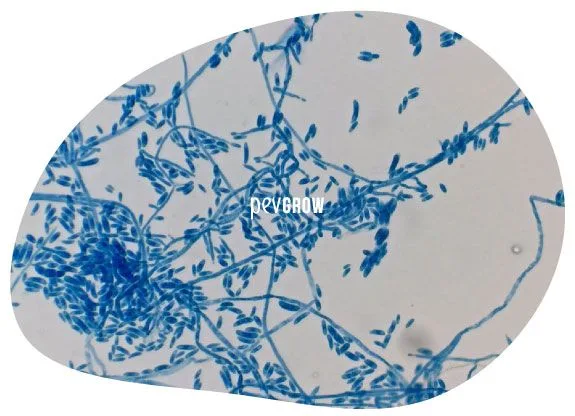 Micrografía de filamentos ramificados y numerosas estructuras ovaladas teñidas de azul, dentro de un recorte ovalado sobre blanco.