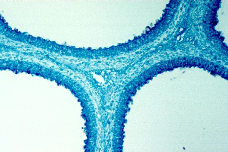 Corte microscópico de tubos de Boletus, con paredes teñidas de azul que delimitan amplias cavidades claras.