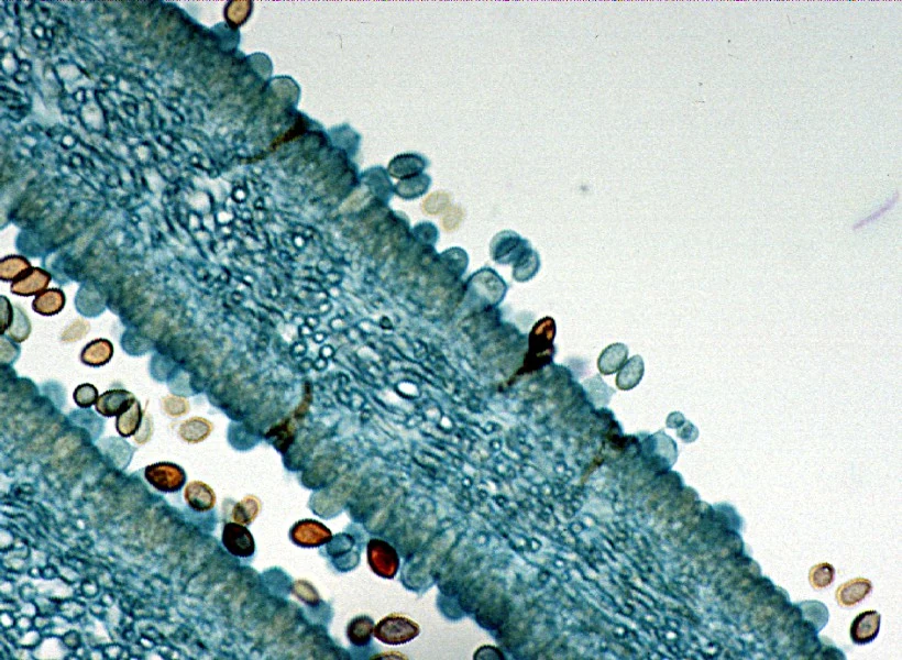Corte microscópico de láminas de Coprinus, con tejido azulado en diagonal y estructuras ovaladas en los bordes y espacios claros.