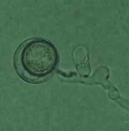 Vista microscópica en tonos verdes de una estructura circular de borde grueso junto a filamentos translúcidos. Vista microscópica en tonos verdes de una estructura circular de borde grueso junto a filamentos translúcidos.
